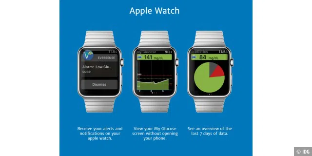Eine App für die Watch kann die Bedienung vereinfachen.
