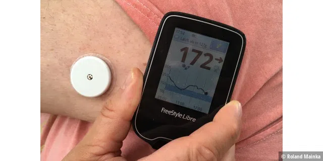 Das FreeStyle Libre CGM der Firma Abbott misst den Blutzuckerwert kontinierlich am Oberarm. Die Werte können mit einem Lesegerät (oder ein iPhone ab Gen. 7 – das der Autor leider nicht besitzt :-( ) über NFC ausgelesen werden. Der Sensor verbleibt 14 Tage am Arm.