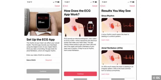 Der erste EKG-Setup-Prozess auf Ihrem iPhone erklärt die Ergebnisse und warnt Sie vor den Einschränkungen des Apple Watch EKG.